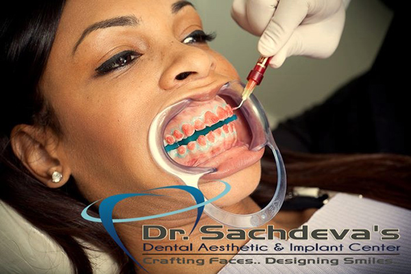 Dental Courses In Delhi,cosmetic dental surgery in delhi ,cosmetic dentist in delhi,Dental Implants Clinic in Delhi,cosmetic dentist delhi,dentist in delhi,dental implant courses in delhi,cost of tooth implant in delhi,tooth implant cost in delhi,cosmetic dentistry in delhi,dental clinic in delhi,laser dentistry courses in delhi,cosmetic dental surgery Delhi